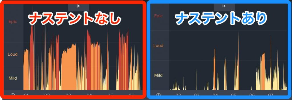 ナステントは保険適用される 最安値で買うオススメの方法まとめ